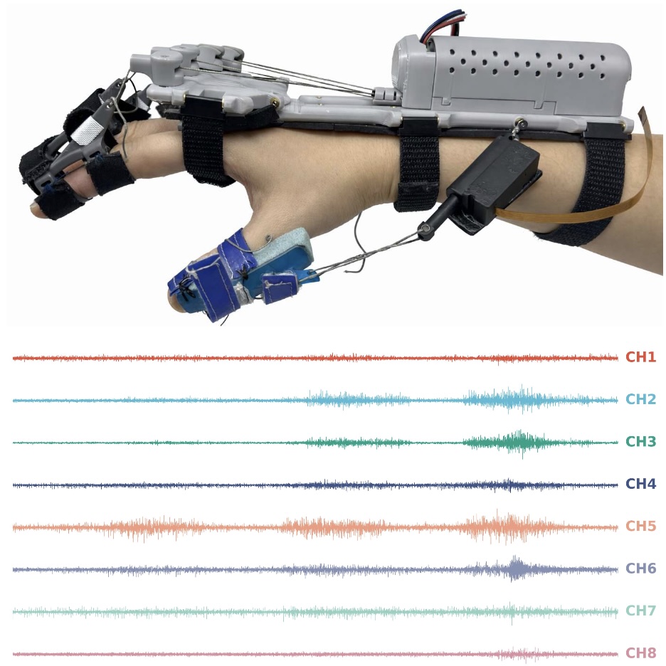 ReactEMG Stroke